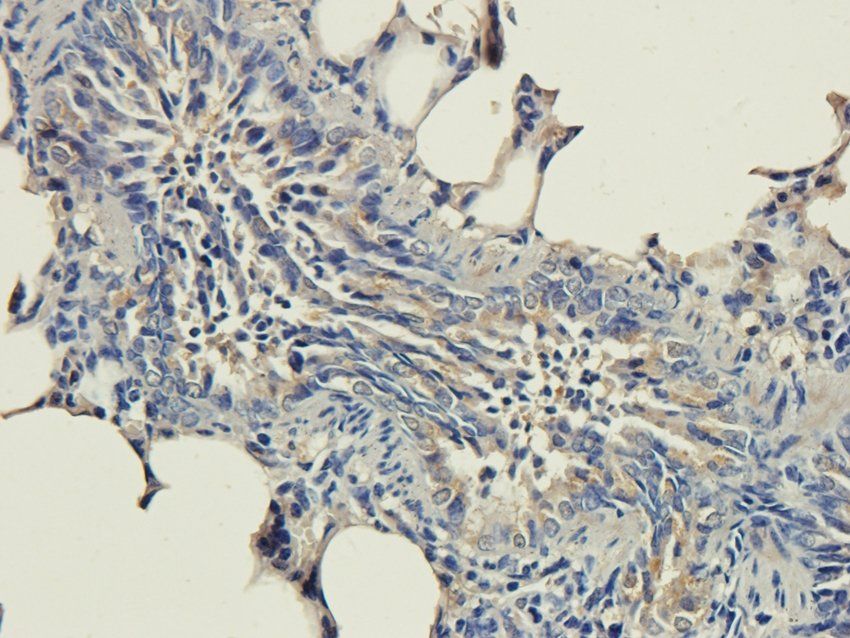 CCR1 Rabbit Polyclonal Antibody