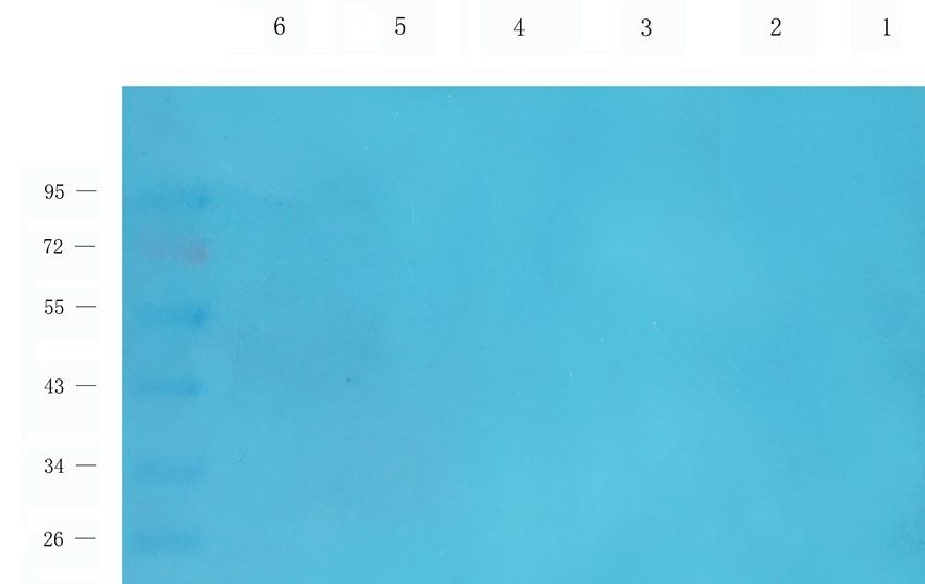 CCR1 Rabbit Polyclonal Antibody