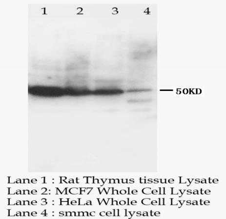 CCR6/CCR6 Rabbit Polyclonal Antibody