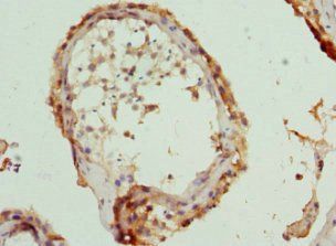 CCT5 Antibody