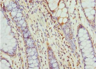 CCT5 Antibody