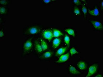 CCT5 Antibody