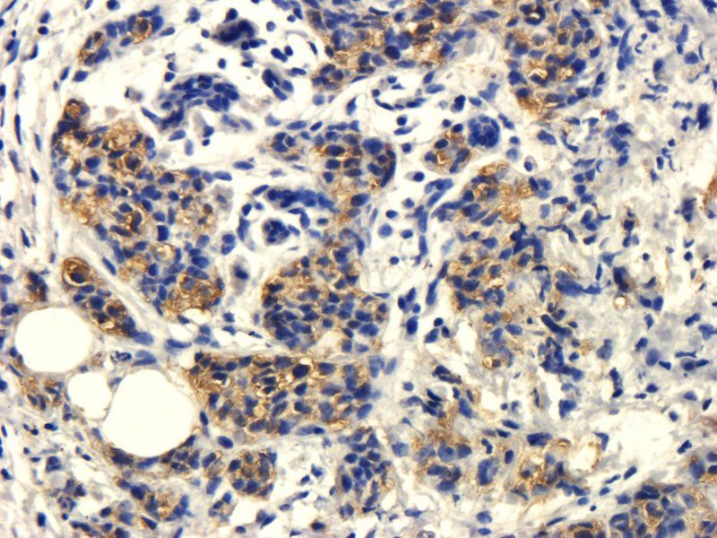 CD105 Rabbit Polyclonal Antibody