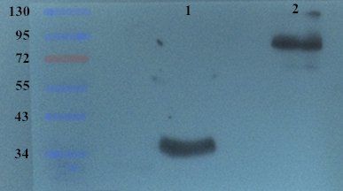 CD105 Rabbit Polyclonal Antibody