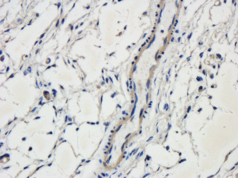 c-Kit Rabbit Polyclonal Antibody