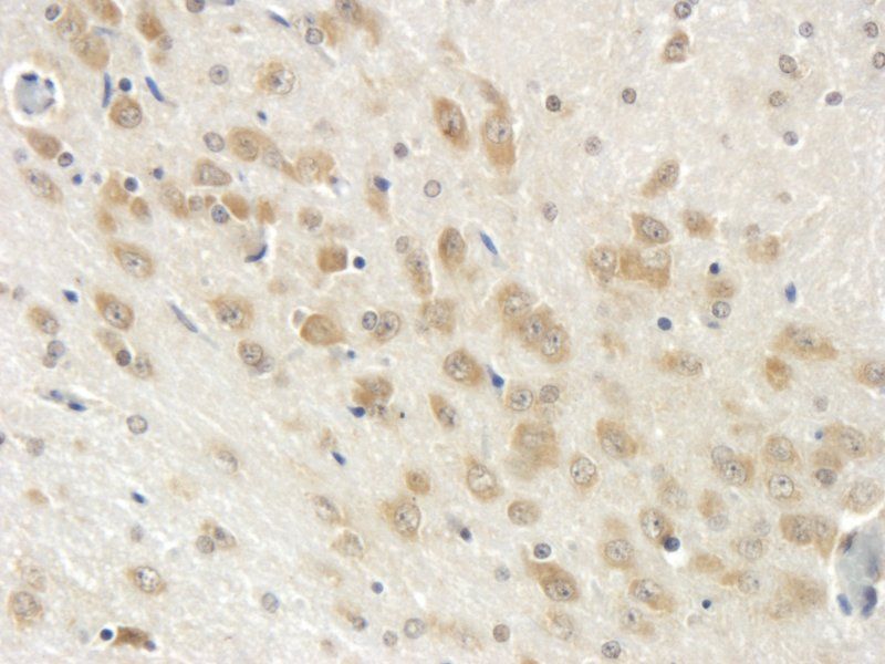 CD11b Rabbit Polyclonal Antibody