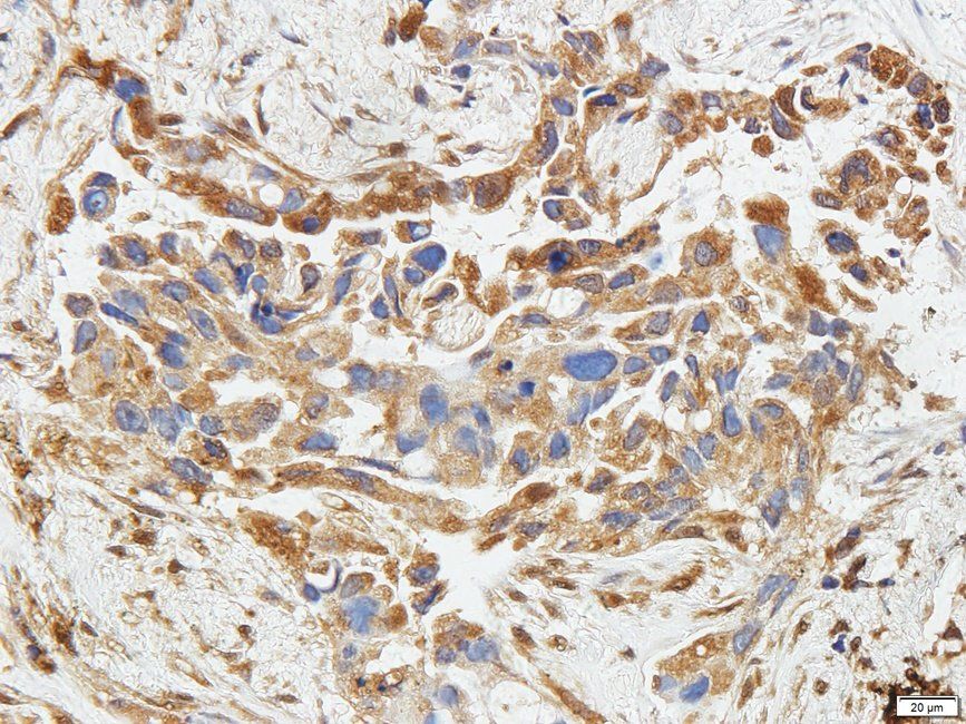 CD11c Rabbit Polyclonal Antibody
