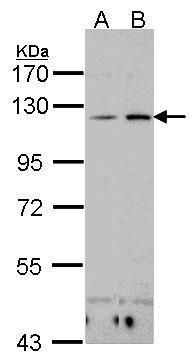 Desmoglein 2 Rabbit Polyclonal Antibody