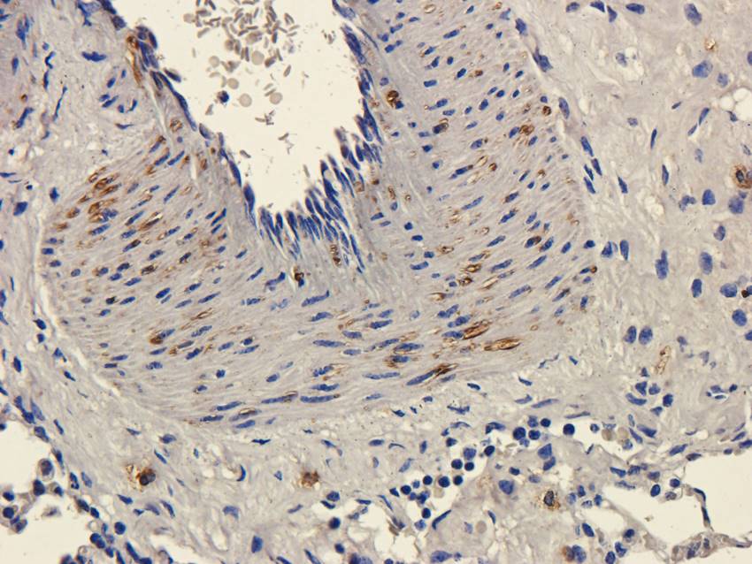 CD11c Rabbit Polyclonal Antibody