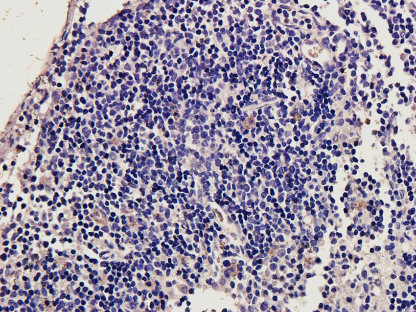CD11c Rabbit Polyclonal Antibody