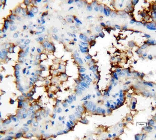 CD133 Rabbit Polyclonal Antibody