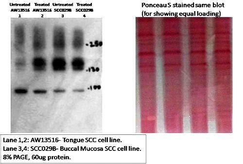 CD133 Rabbit Polyclonal Antibody