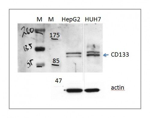 CD133 Rabbit Polyclonal Antibody