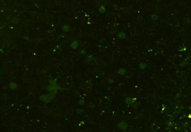 CD133 Rabbit Polyclonal Antibody (FITC)