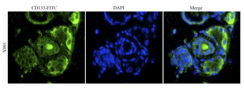 CD133 Rabbit Polyclonal Antibody (FITC)
