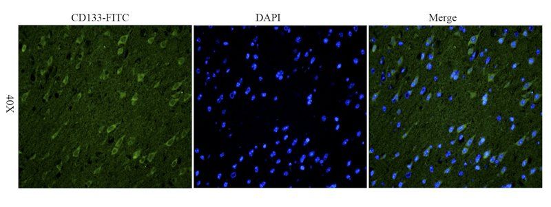 CD133 Rabbit Polyclonal Antibody (FITC)