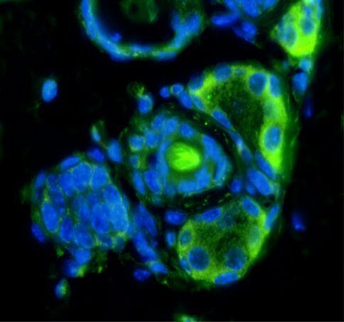 CD133 Rabbit Polyclonal Antibody (FITC)