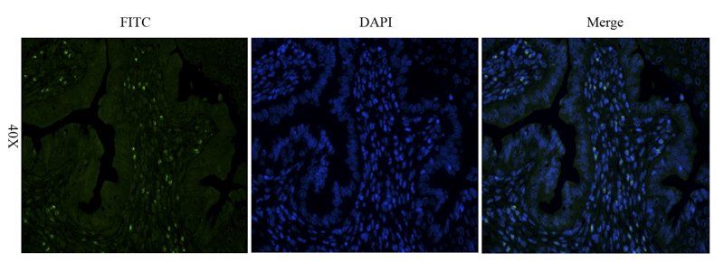 CD133 Rabbit Polyclonal Antibody (FITC)