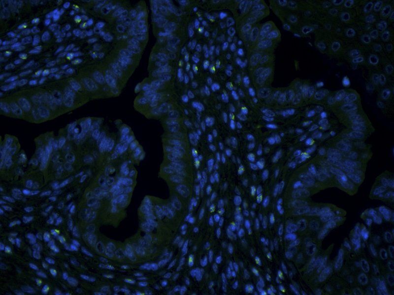 CD133 Rabbit Polyclonal Antibody (FITC)