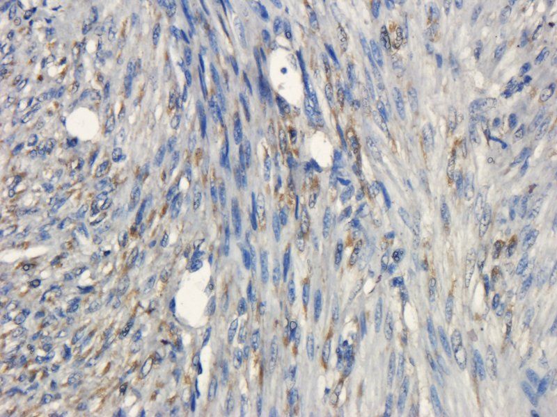 CD133 Rabbit Polyclonal Antibody