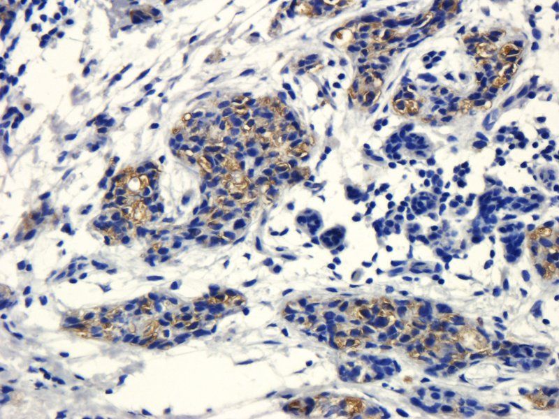 CD133 Rabbit Polyclonal Antibody