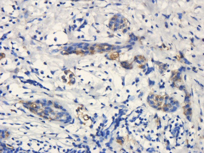 CD133 Rabbit Polyclonal Antibody