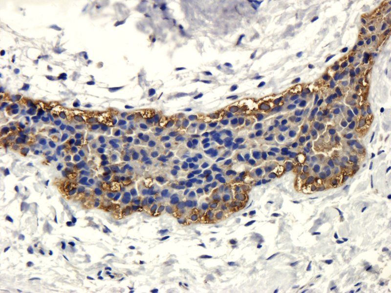 CD133 Rabbit Polyclonal Antibody