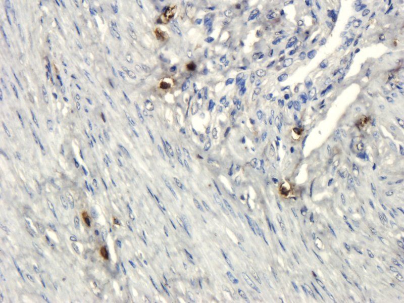 CD133 Rabbit Polyclonal Antibody