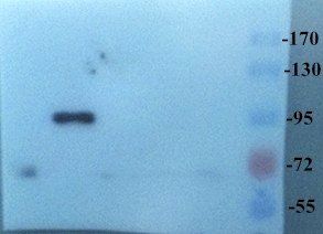 CD133 Rabbit Polyclonal Antibody