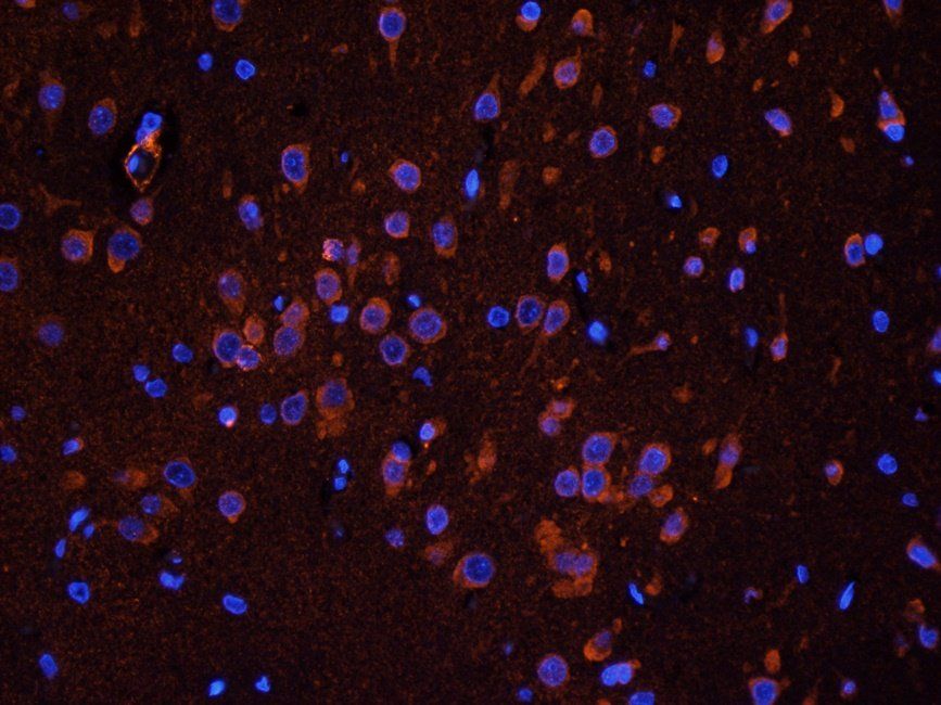 CD137 Rabbit Polyclonal Antibody