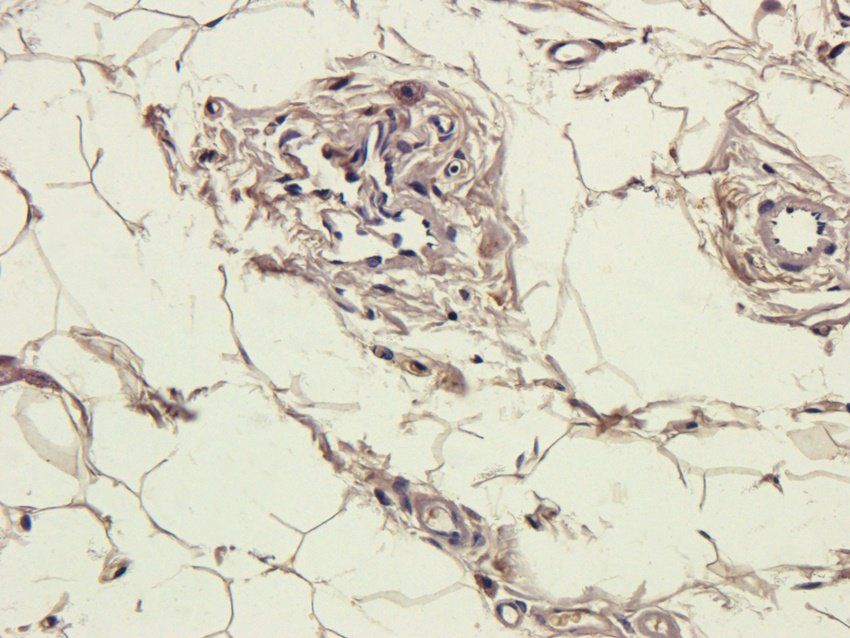 CD137 Rabbit Polyclonal Antibody