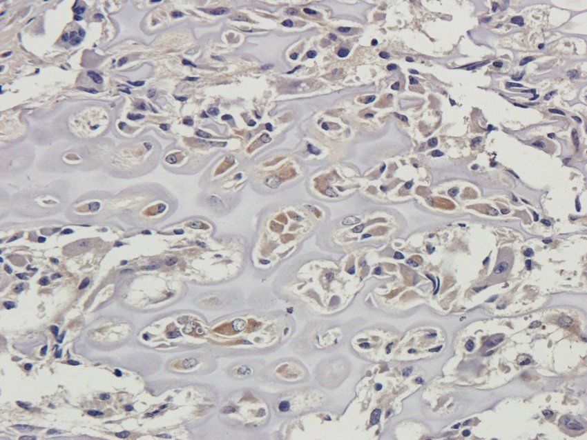 CD137 Rabbit Polyclonal Antibody