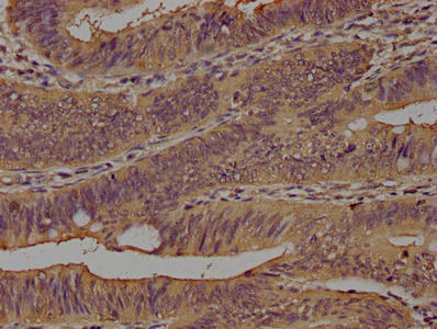CD14 Antibody