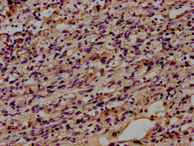 CD14 Antibody