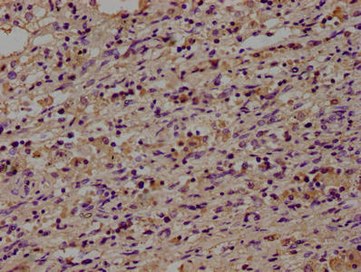 CD14 Antibody