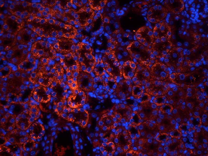 CD146 Rabbit Polyclonal Antibody