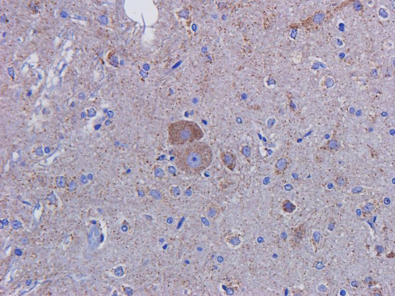CD146 Rabbit Polyclonal Antibody