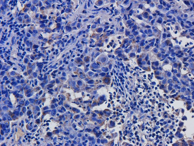 CD146 Rabbit Polyclonal Antibody