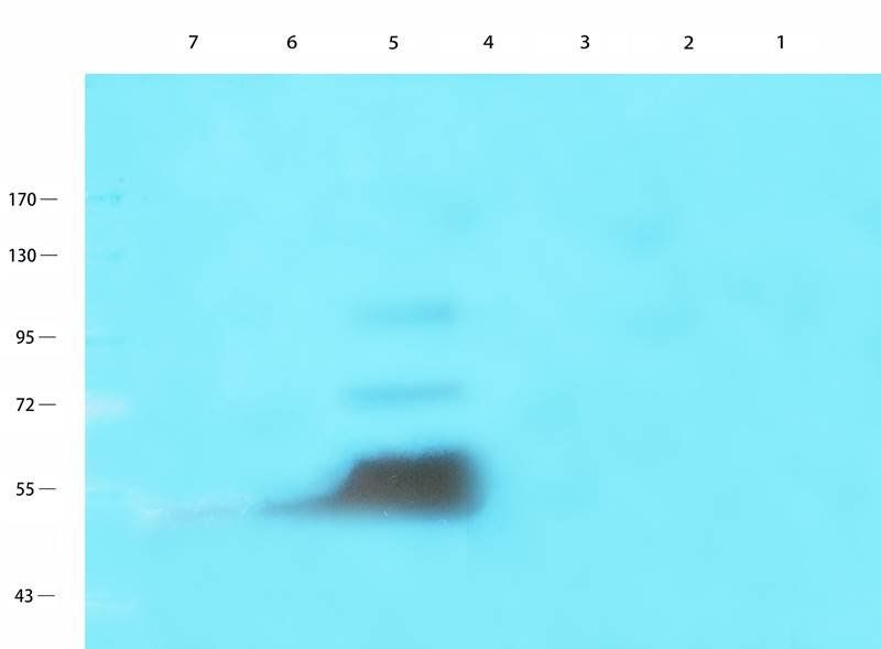CD146 Rabbit Polyclonal Antibody