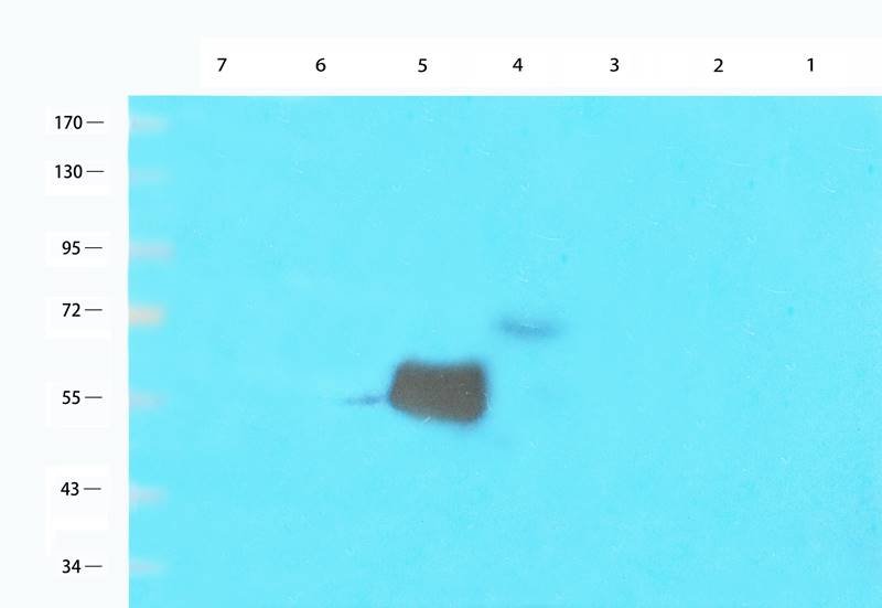 CD146 Rabbit Polyclonal Antibody