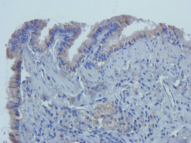 CD14 Rabbit Polyclonal Antibody