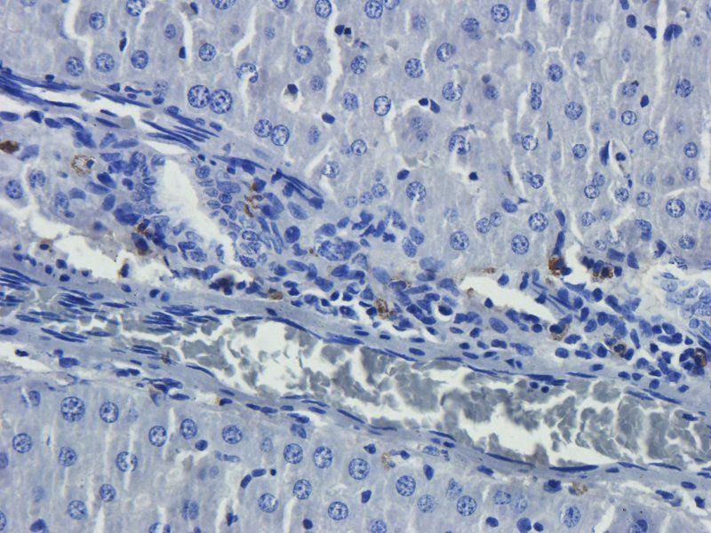 CD14 Rabbit Polyclonal Antibody