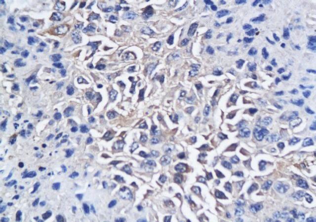 CD150/SLAM Rabbit Polyclonal Antibody