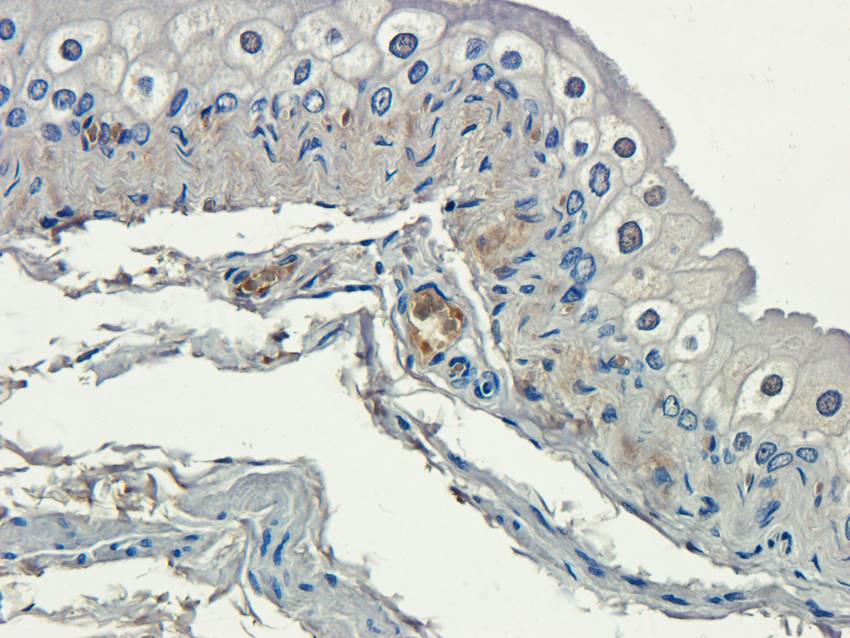 CD155 Rabbit Polyclonal Antibody