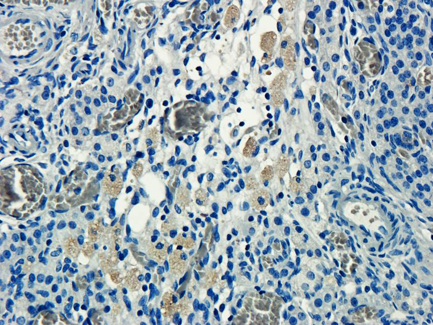 CD155 Rabbit Polyclonal Antibody