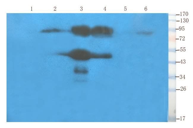 CD155 Rabbit Polyclonal Antibody