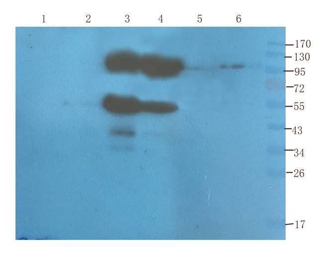 CD155 Rabbit Polyclonal Antibody