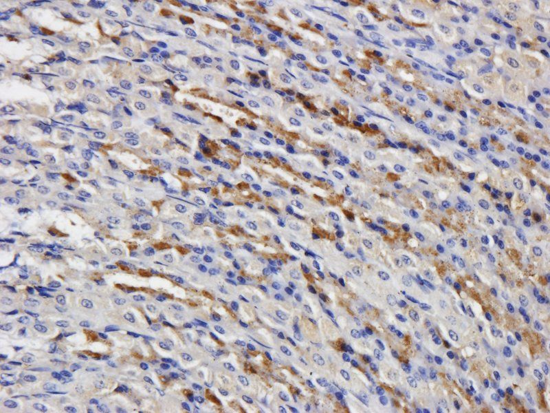 CD15 Rabbit Polyclonal Antibody