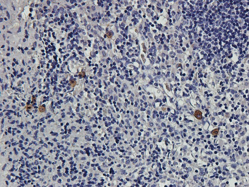 CD163 Rabbit Polyclonal Antibody