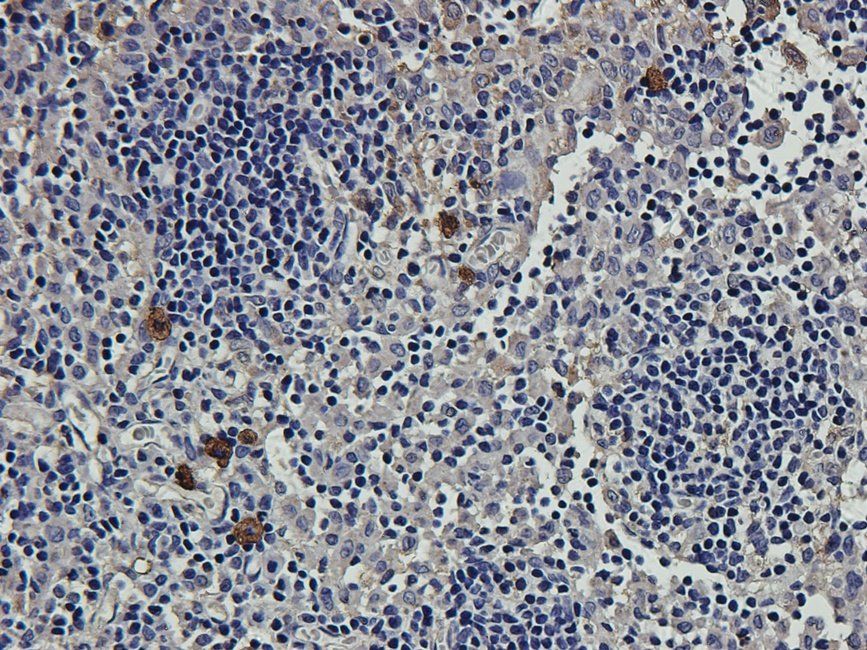 CD163 Rabbit Polyclonal Antibody